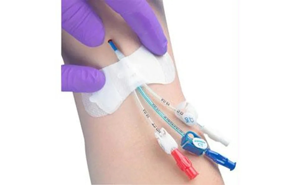 Grip-lok Securement Device For Universal Picc Catheter, 3-1 2 , 1 4 - 1 2 Tubing