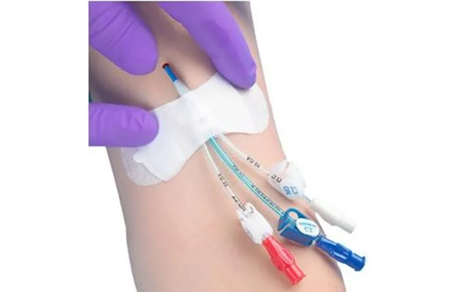 Zefon Tidi Grip-loksecurement Device - For Universal Picc Catheter