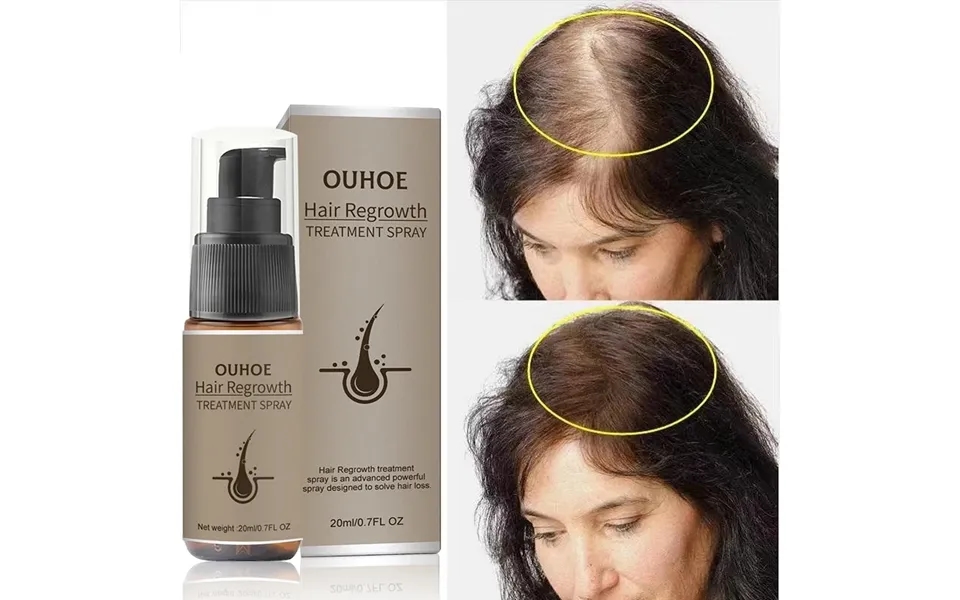 Fast Hair Growth Spray Products Anti Hair Loss Serum Prevent Baldness Treatment Scalp Dry Damaged Essential Oil Hair Bea