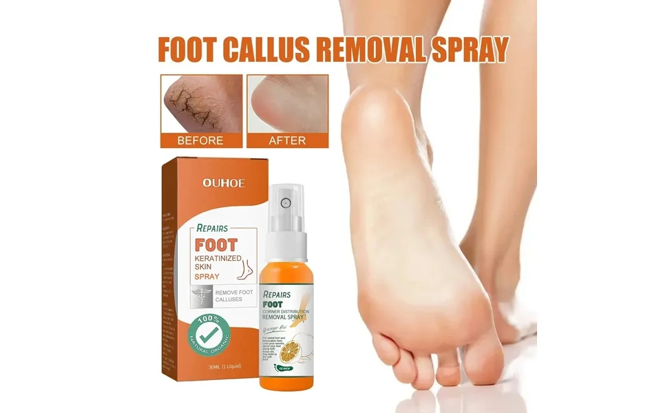 Foot Peeling Spray Anti Drying Crack Heel Elbow Knee Hands Dead Skin Calluses Exfoliator Softener Whiten Feet Repair Liq