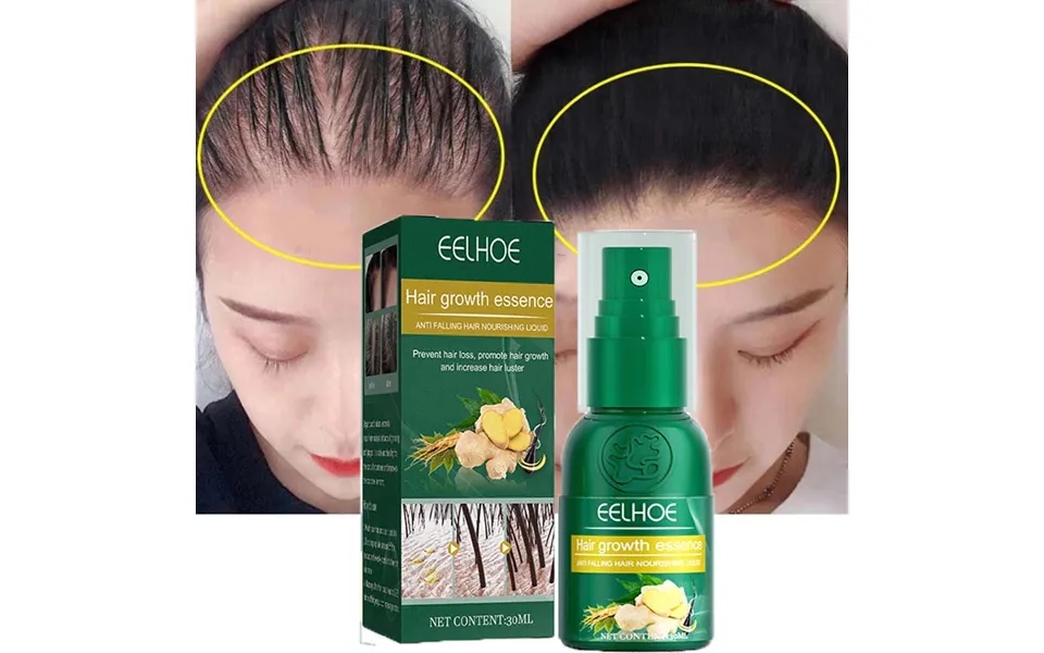 Ginger Hair Growth Spray Products Natural Anti Hair Loss Serum Prevent Baldness Treatment Fast Grows Nourish Damaged Hai