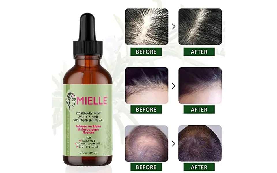 Hair Growth Essential Oil Rosemary Mint Hair Strengthening Oil Nourishing Treatment For Mielle Dry 100%pure Hair Care Es