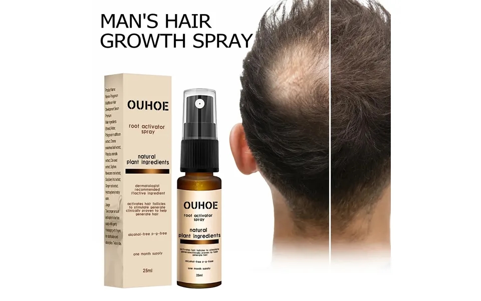 Hair Loss Treatment Spray Nourishing Regrowth Root Thicken Anti Fall Prevent Baldness Repair Damage Grow Hair Essence Sp