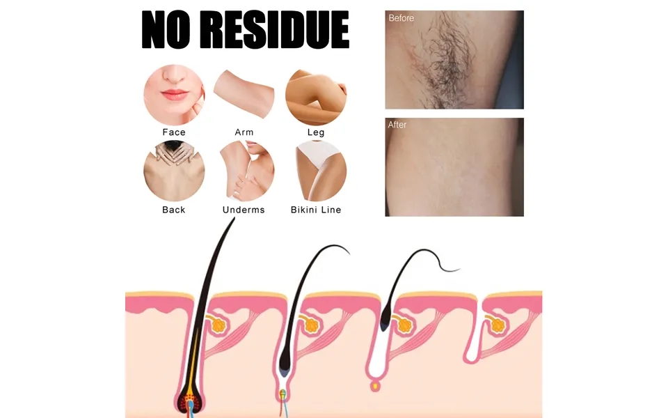 Most Popular Armpit Mild Refreshing And Non Stimulating Fine Smooth Hair Removal Spray