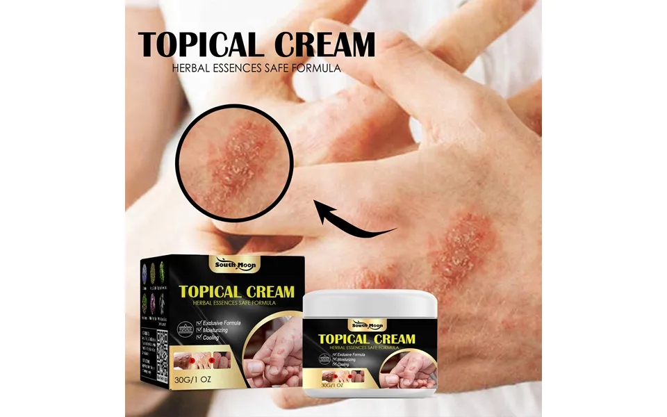 South Moon Anti-itch Cream For Hands And Feet - Skin Dry