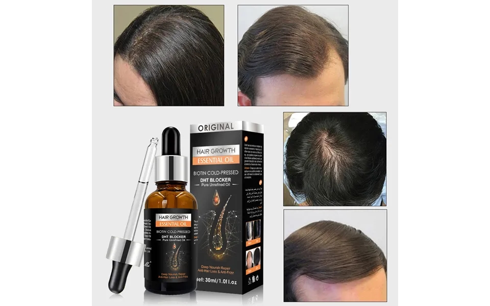 Wash Ginger Scalp Free Hair Care Massage Essential Hair Growth Oil